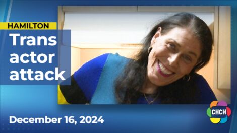 Transgender Hamilton woman gets new teeth after violent assault