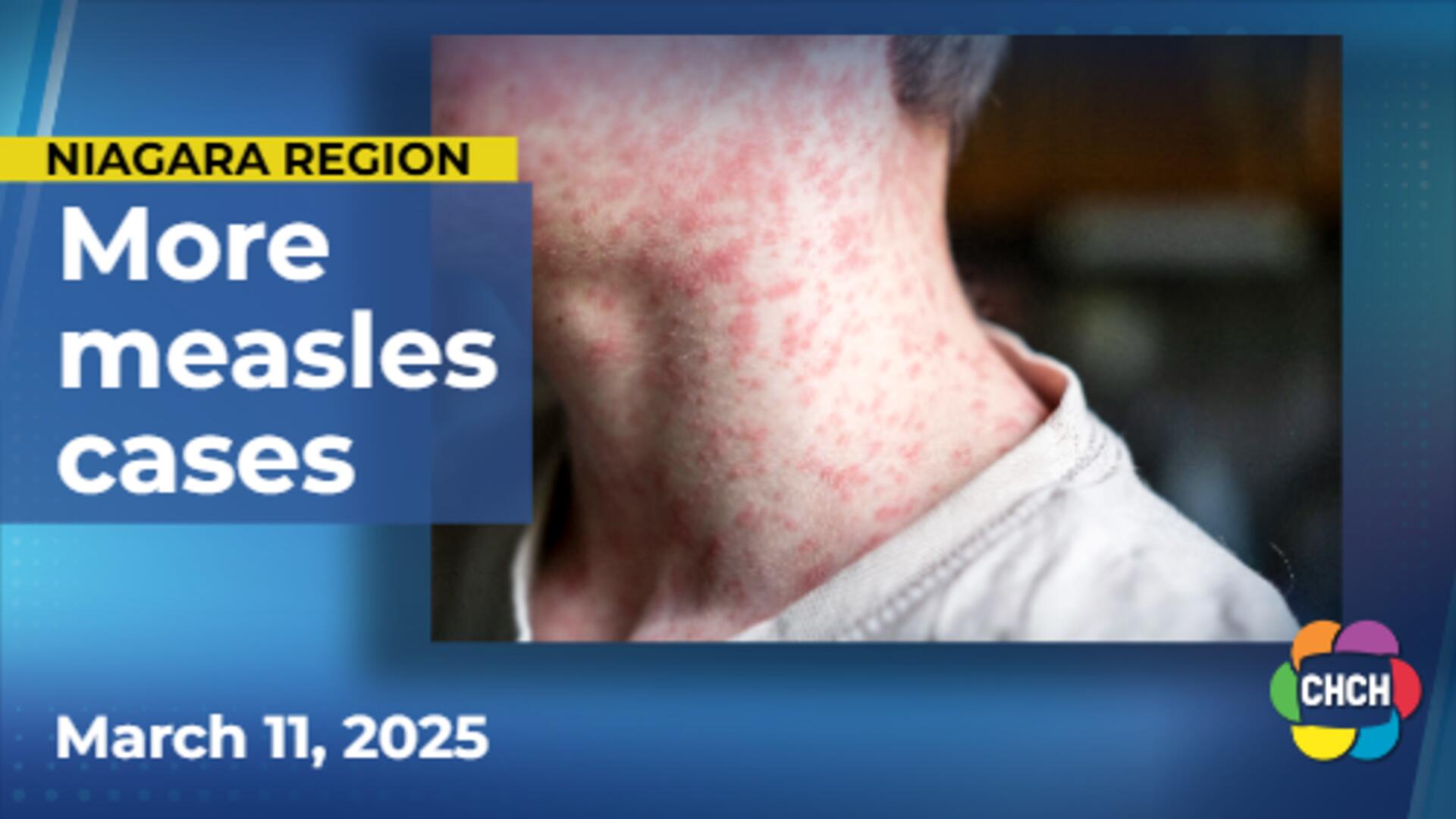 Grand Erie Public Health confirms new measles exposure location